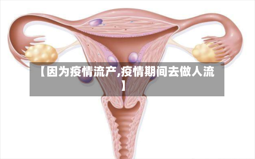【因为疫情流产,疫情期间去做人流】-第3张图片