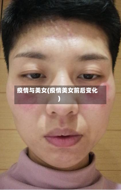 疫情与美女(疫情美女前后变化)-第2张图片