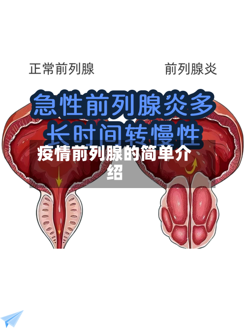 疫情前列腺的简单介绍-第2张图片