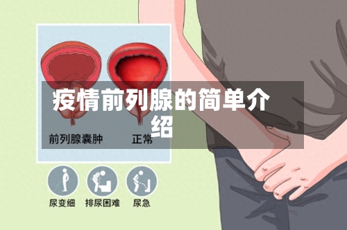 疫情前列腺的简单介绍