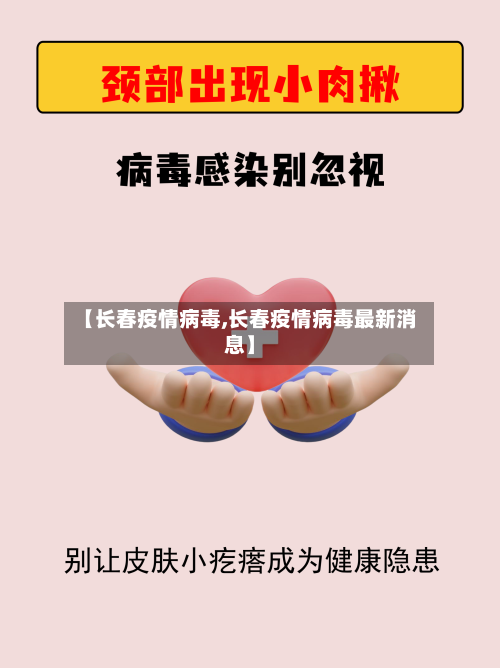 【长春疫情病毒,长春疫情病毒最新消息】-第2张图片