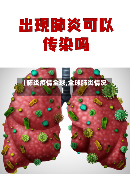 【肺炎疫情全球,全球肺炎情况】