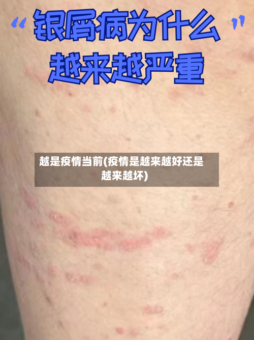 越是疫情当前(疫情是越来越好还是越来越坏)-第3张图片