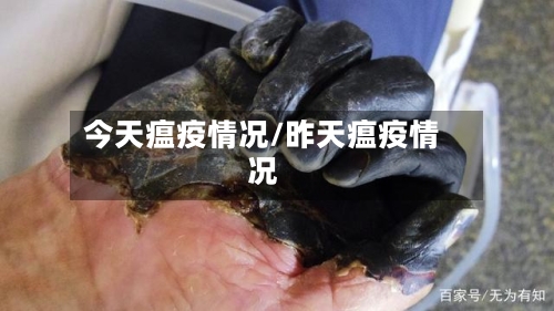 今天瘟疫情况/昨天瘟疫情况