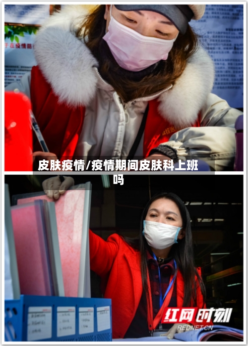 皮肤疫情/疫情期间皮肤科上班吗-第3张图片