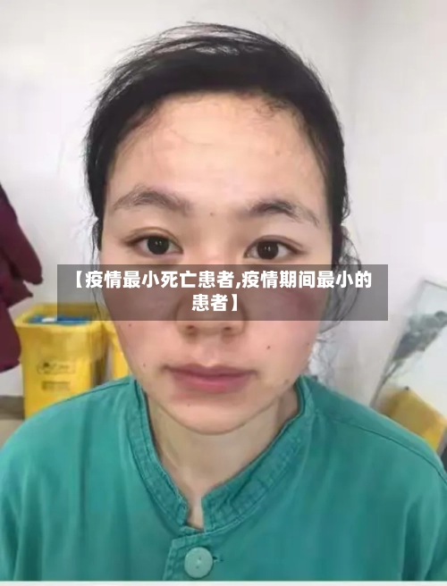【疫情最小死亡患者,疫情期间最小的患者】-第2张图片