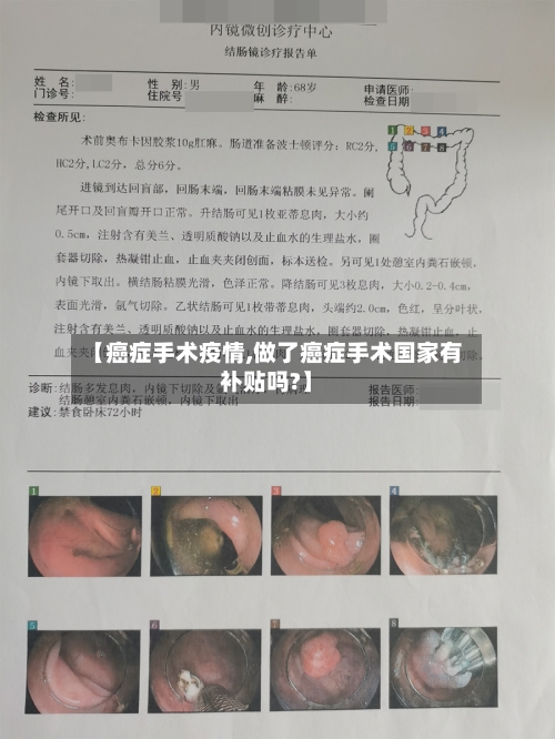 【癌症手术疫情,做了癌症手术国家有补贴吗?】-第2张图片
