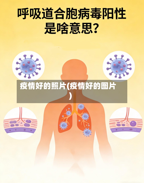 疫情好的照片(疫情好的图片)-第2张图片