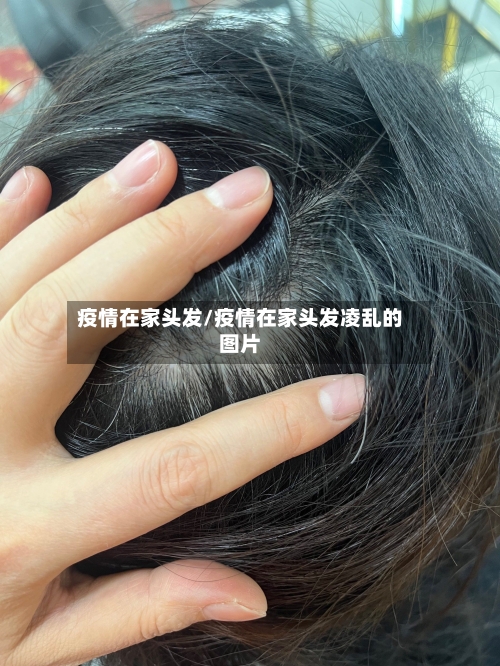 疫情在家头发/疫情在家头发凌乱的图片-第2张图片