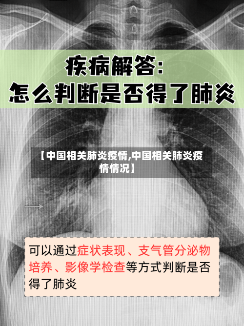 【中国相关肺炎疫情,中国相关肺炎疫情情况】-第2张图片