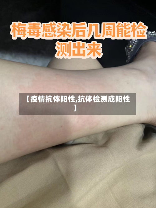 【疫情抗体阳性,抗体检测成阳性】