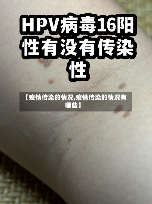 【疫情传染的情况,疫情传染的情况有哪些】-第3张图片