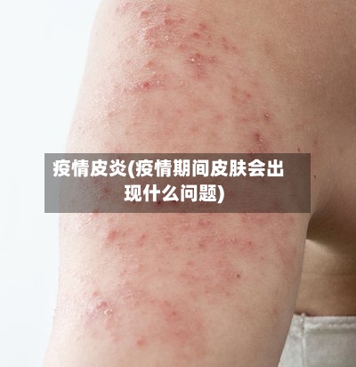 疫情皮炎(疫情期间皮肤会出现什么问题)