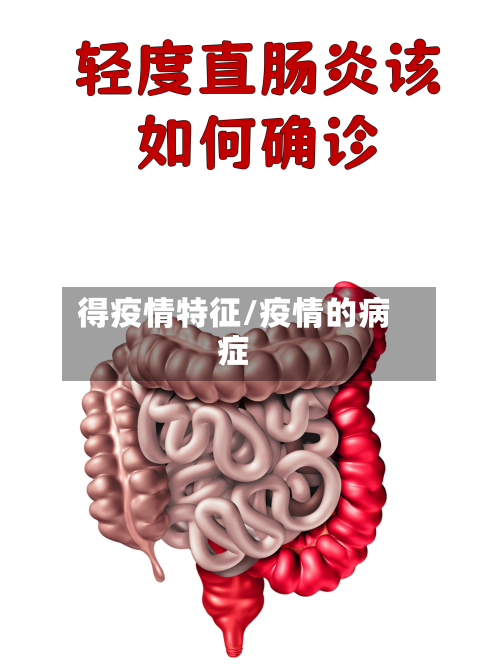 得疫情特征/疫情的病症-第2张图片