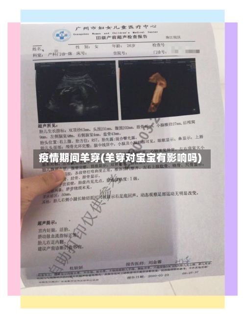 疫情期间羊穿(羊穿对宝宝有影响吗)-第2张图片