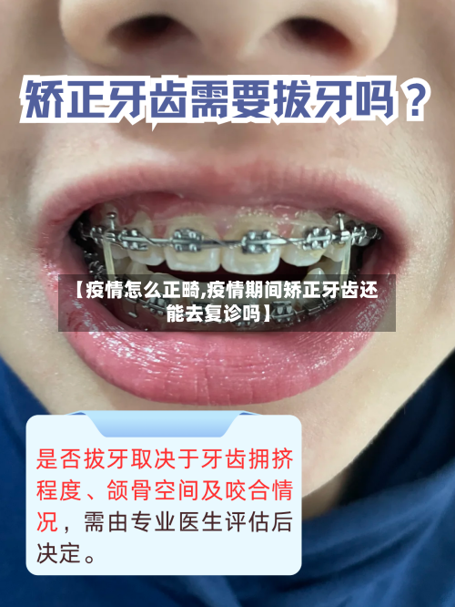 【疫情怎么正畸,疫情期间矫正牙齿还能去复诊吗】-第2张图片