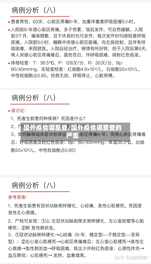 国外疫情哪里查/国外疫情哪里查的严重
