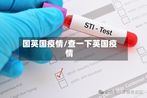 国英国疫情/查一下英国疫情-第2张图片