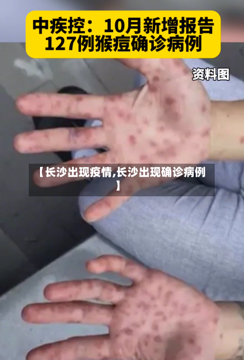 【长沙出现疫情,长沙出现确诊病例】