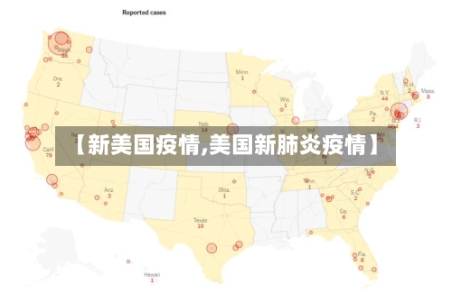【新美国疫情,美国新肺炎疫情】-第2张图片