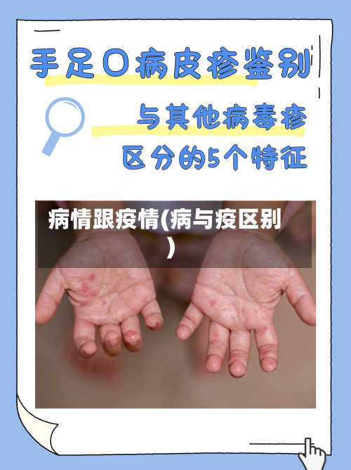 病情跟疫情(病与疫区别)