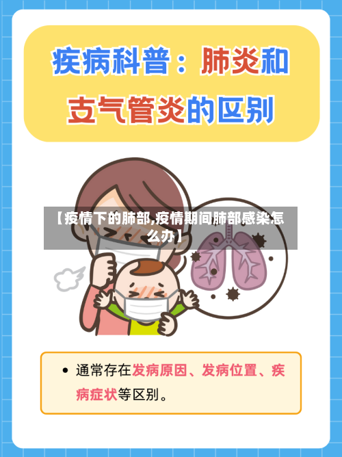 【疫情下的肺部,疫情期间肺部感染怎么办】-第3张图片