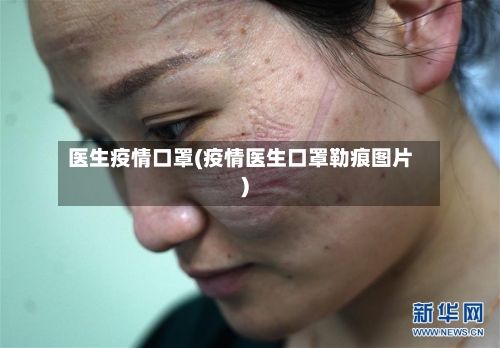 医生疫情口罩(疫情医生口罩勒痕图片)