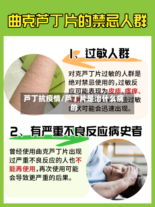 芦丁抗疫情/芦丁片是治什么病的-第2张图片