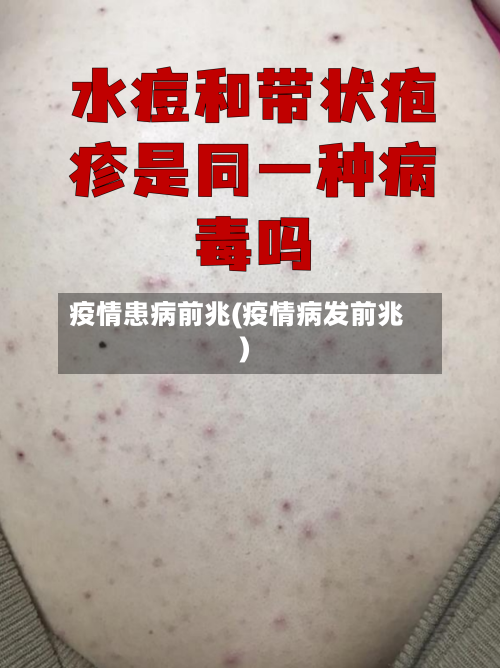疫情患病前兆(疫情病发前兆)