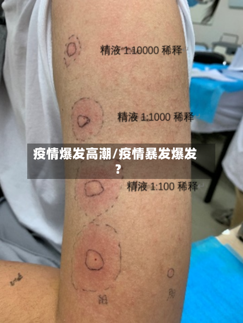 疫情爆发高潮/疫情暴发爆发?