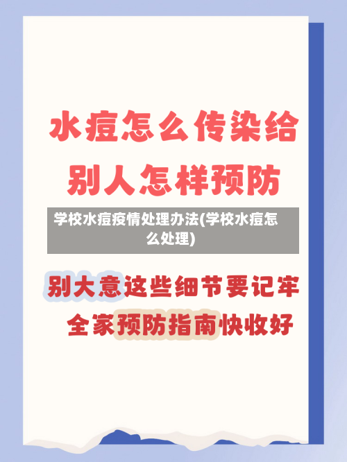 学校水痘疫情处理办法(学校水痘怎么处理)-第2张图片
