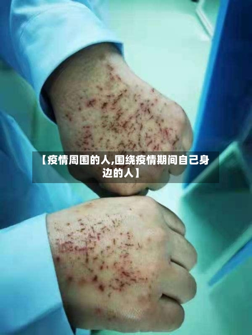 【疫情周围的人,围绕疫情期间自己身边的人】-第2张图片