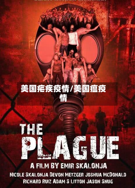 美国疟疾疫情/美国瘟疫情