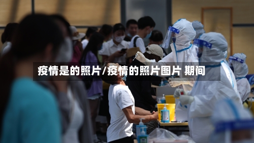 疫情是的照片/疫情的照片图片 期间