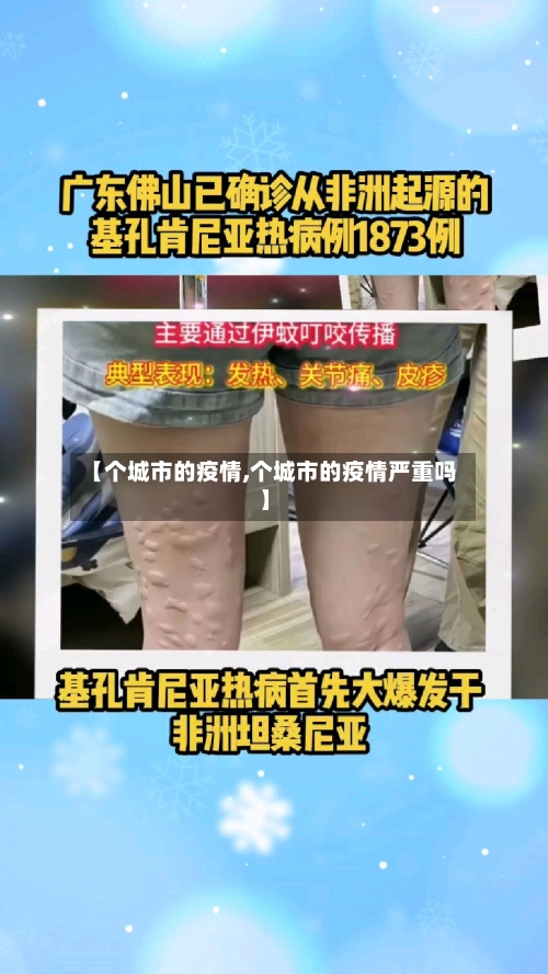 【个城市的疫情,个城市的疫情严重吗】