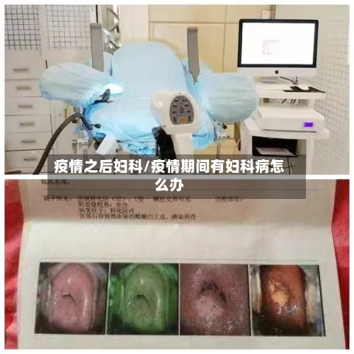 疫情之后妇科/疫情期间有妇科病怎么办