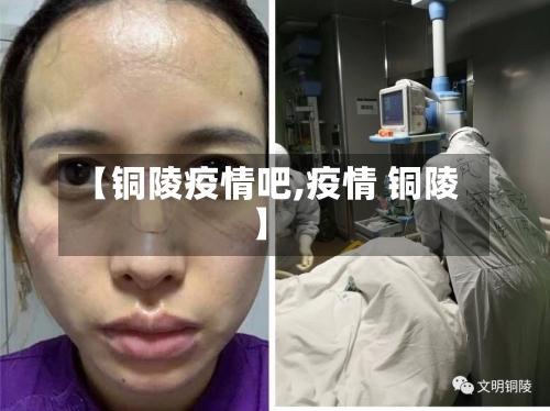 【铜陵疫情吧,疫情 铜陵】-第2张图片