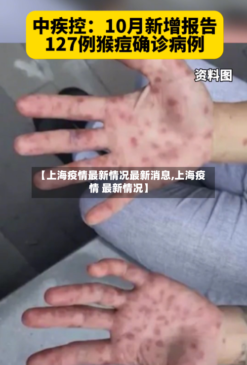 【上海疫情最新情况最新消息,上海疫情 最新情况】-第2张图片