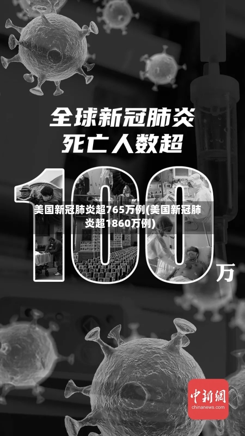美国新冠肺炎超765万例(美国新冠肺炎超1860万例)