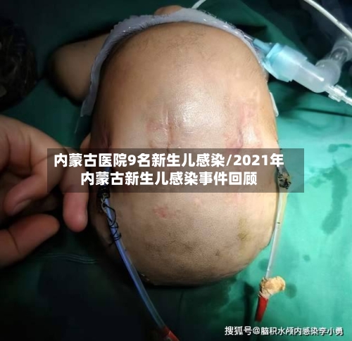 内蒙古医院9名新生儿感染/2021年内蒙古新生儿感染事件回顾-第2张图片