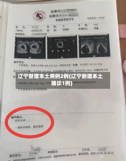 辽宁新增本土病例2例(辽宁新增本土确诊1例)-第2张图片