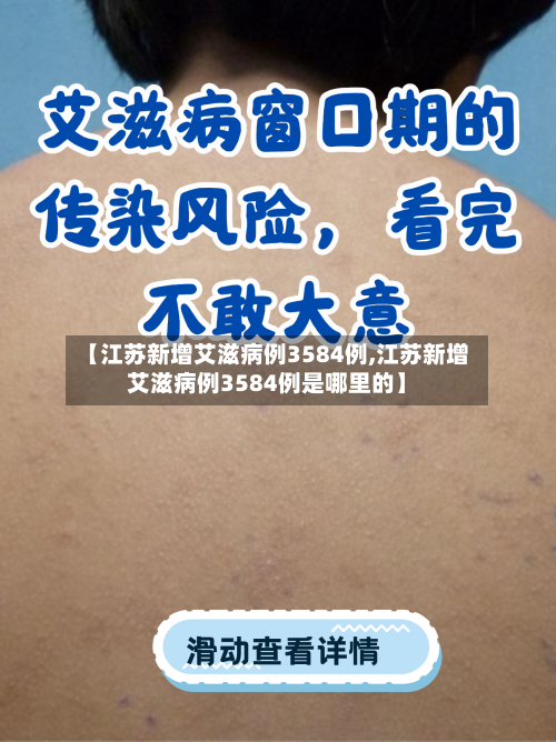 【江苏新增艾滋病例3584例,江苏新增艾滋病例3584例是哪里的】