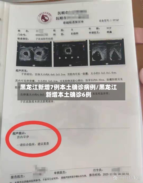 黑龙江新增7例本土确诊病例/黑龙江新增本土确诊6例-第2张图片