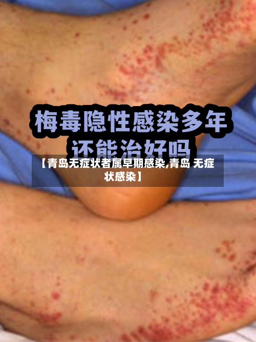 【青岛无症状者属早期感染,青岛 无症状感染】