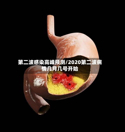 第二波感染高峰预测/2020第二波病情几月几号开始-第3张图片