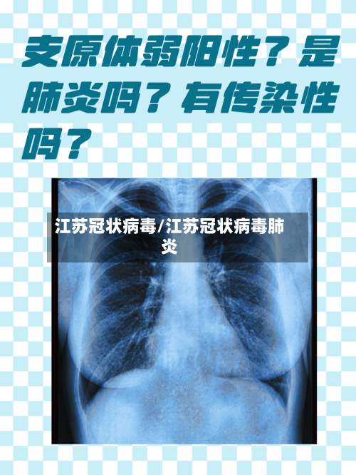 江苏冠状病毒/江苏冠状病毒肺炎