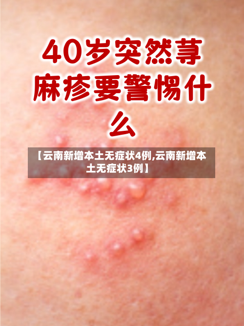 【云南新增本土无症状4例,云南新增本土无症状3例】