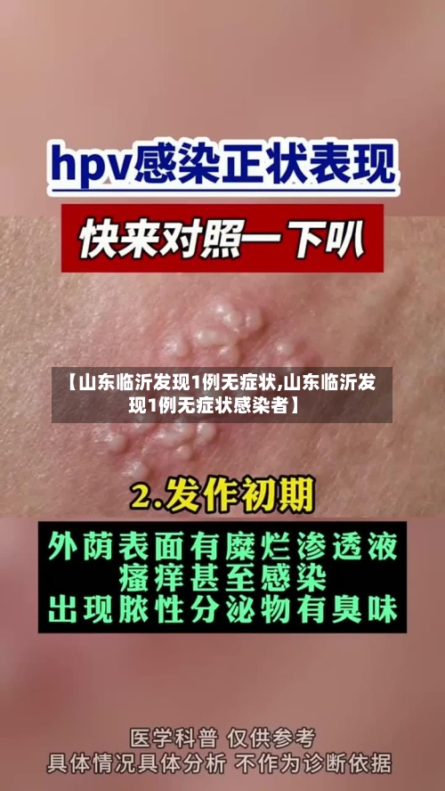 【山东临沂发现1例无症状,山东临沂发现1例无症状感染者】