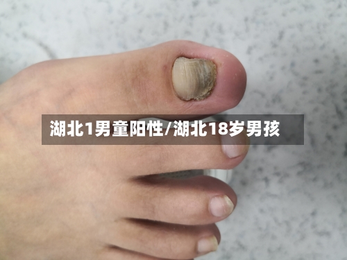湖北1男童阳性/湖北18岁男孩-第2张图片